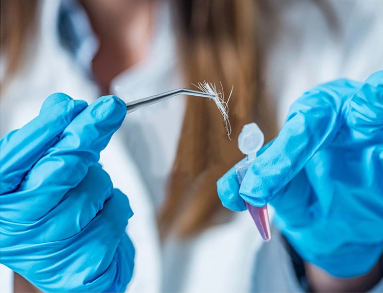 MS2Vertical 9100 應(yīng)對(duì)毛發(fā)中常見毒品和鎮(zhèn)靜劑的測(cè)定分析解決方案